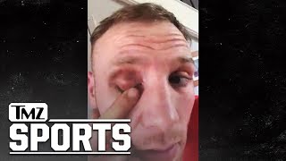 Conor McGregor Hit Me with Brutal, Cheap Shot on Video, Boxer Claims | TMZ Sports