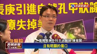 醫院引進微創手術 甲狀腺開刀傷口小-民視新聞
