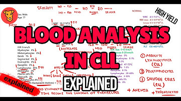 Chronic Lymphocytic Leukemia (CLL) Blood Analysis EXPLAINED: Diagnostic Algorithm (Beginner’s Guide)