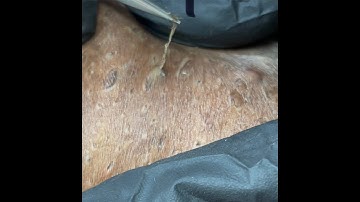 Extraction Brazilian Area (2 wigs)