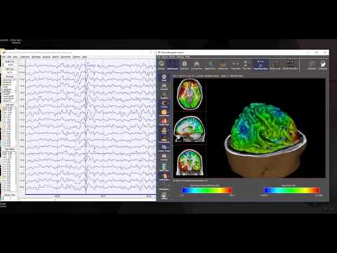 NeuroNavigator and the Time domain Capture of Specific EEG Events