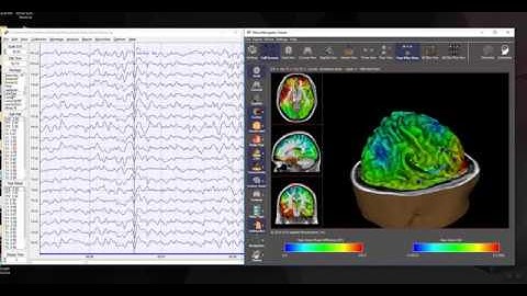 NeuroNavigator and the Time domain Capture of Specific EEG Events