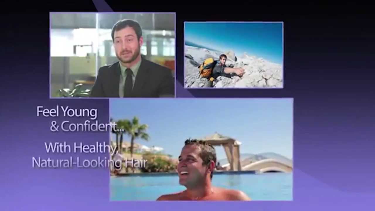 Sure Hair International RFUE Hair Transplant Toronto, Ontario (416