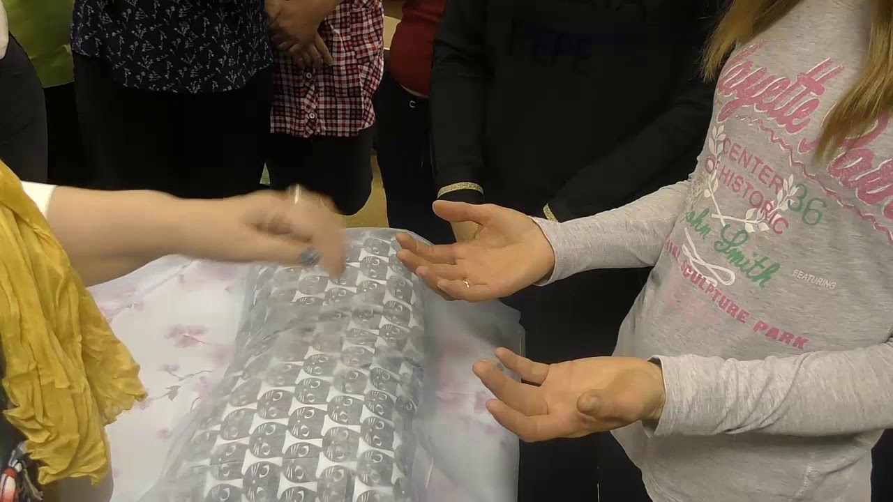 Контрактура Дюпюитрена. Диагностика ладоней - YouTube