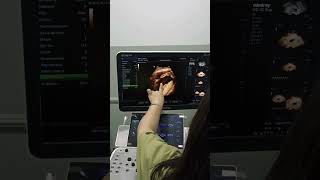 Onajon Ącamuzyka Video