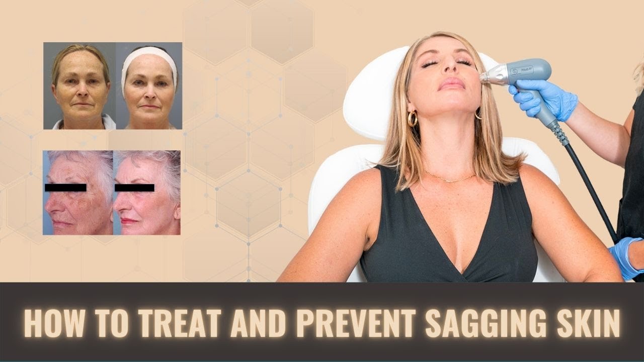 Best Treatment for Sagging Skin