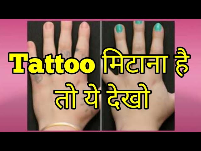 टट मटन क 7 आसन घरल उपय  Tattoo Remove Kaise Kare