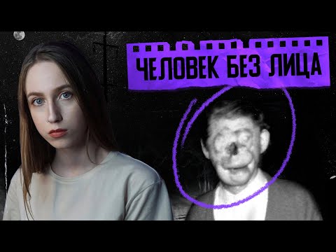 ЖУТКАЯ ИСТОРИЯ ЧЕЛОВЕКА БЕЗ ЛИЦА | Рэймонд Робинсон | Зеленый человек