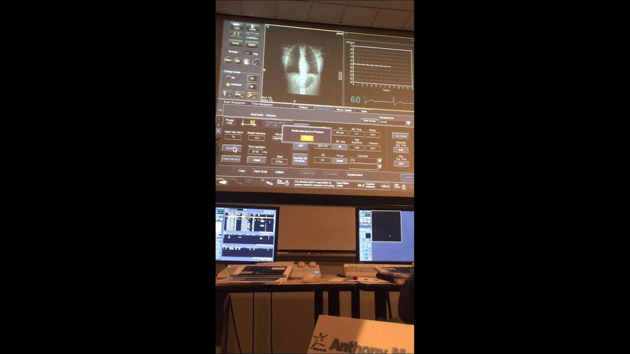 Cardiac protocol! Toshiba aquilion One