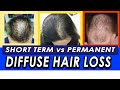 Permanent vs Temporary Diffuse Hair Loss and Telogen Effluvium. How to differentiate?