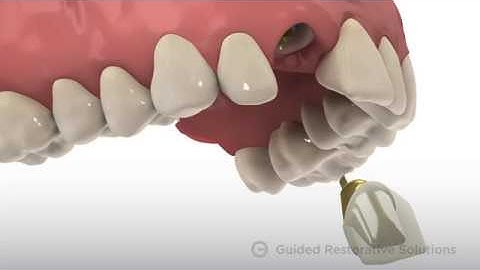 Vulcan Overview Video