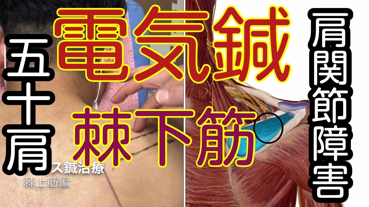 最新　鍼灸治療学　上巻・下巻セット 最新 鍼灸治療学上・下巻セット 木下晴都 著 医道の日本社 最新