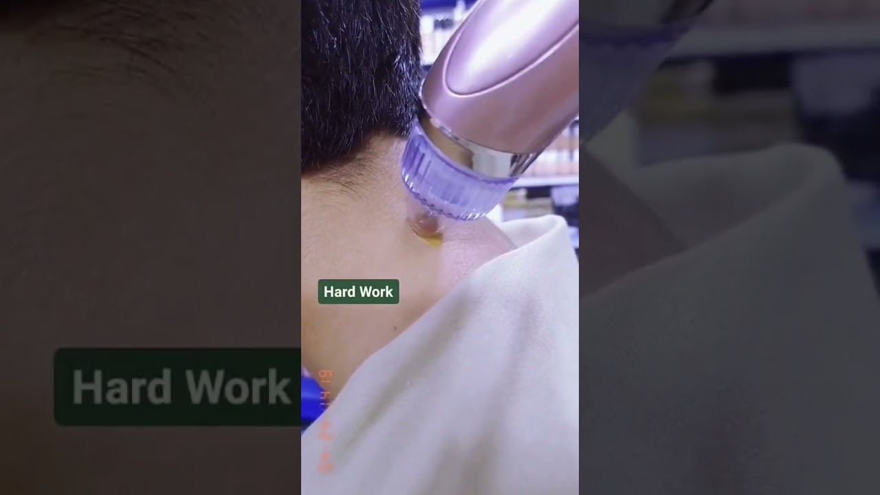 Vacuum Acne Pore Cleaner 