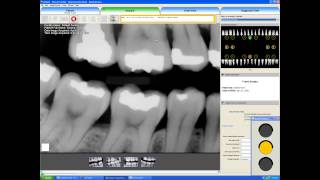 EVAsoft - Acquiring an Image screenshot 2