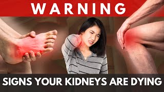 11 Warning Signs Your Kidneys Are Dying, Toxic Kidney