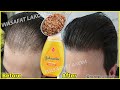 Put these ingredients in your shampoo, 🌾 it accelerates hair growth and treats baldness
