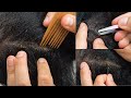 Asmr super tingly scalp scratching  nitpicking with tweezers