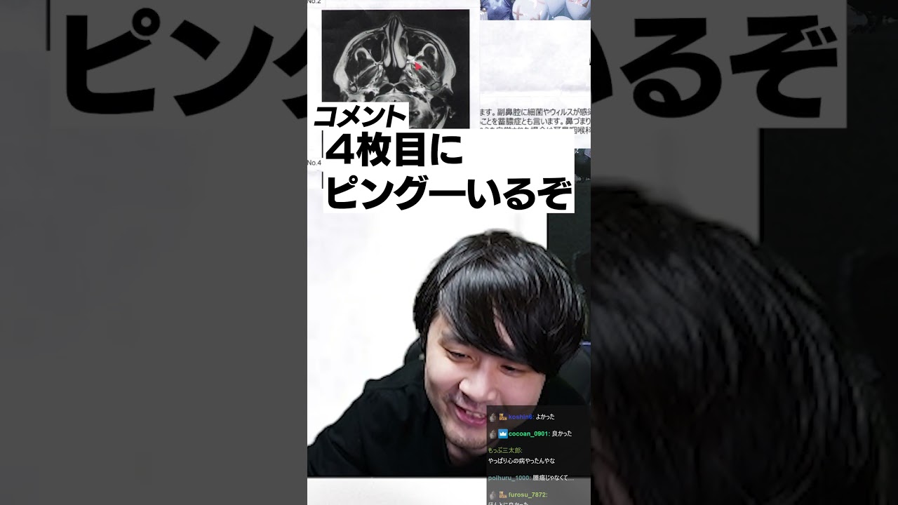 まさかの伏線回収】MRI検査で脳を診てもらったら頭の中にピングーが