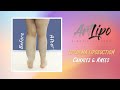 Lipedema Leg Transformation | Cankles &amp; Knees Complex |  | Lipo 360° | Expert Dr. Thomas Su