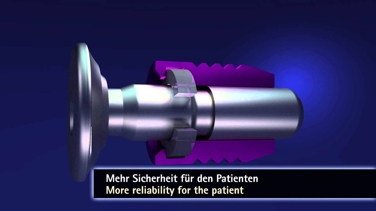 Easy-Snap Steckriegelsystem