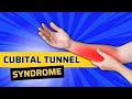 Cubital Tunnel Syndrome? (Cell Phone Elbow) vs Herniated Disc-Neck