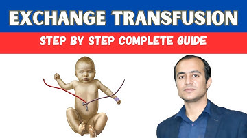 Exchange Transfusion Procedure: Step-by-Step Guide for Doctors & Medical Students
