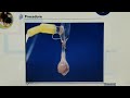 P&T Expt 9 Effect of potassium and calcium ions on frog's heart