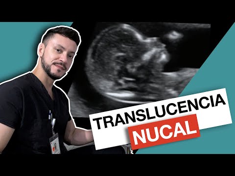 Vídeo: Per què es fa la translucidència nucal?