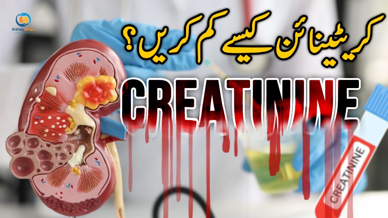 Можно ли действительно снизить уровень креатинина? Факты, разрушающие мифы — Выпуск 90 | AwaisZak...