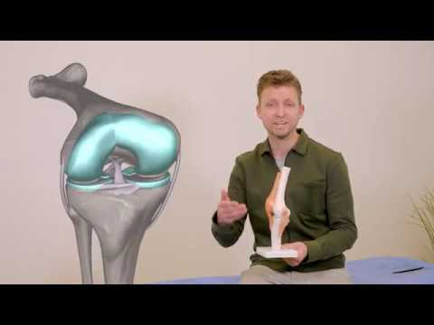 Video: Patella - Structuur, Functie, Ligamenten, Verplaatsing, Dislocatie, Breuk