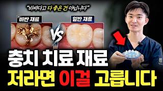 충치 치료, 부위별 재료 선택 기준 솔직히 말씀드립니다. 치과 가기 전 꼭 보세요