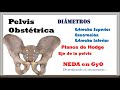 Pelvis Obstétrica. Diámetros. Planos de Hodge. Eje de la pelvis