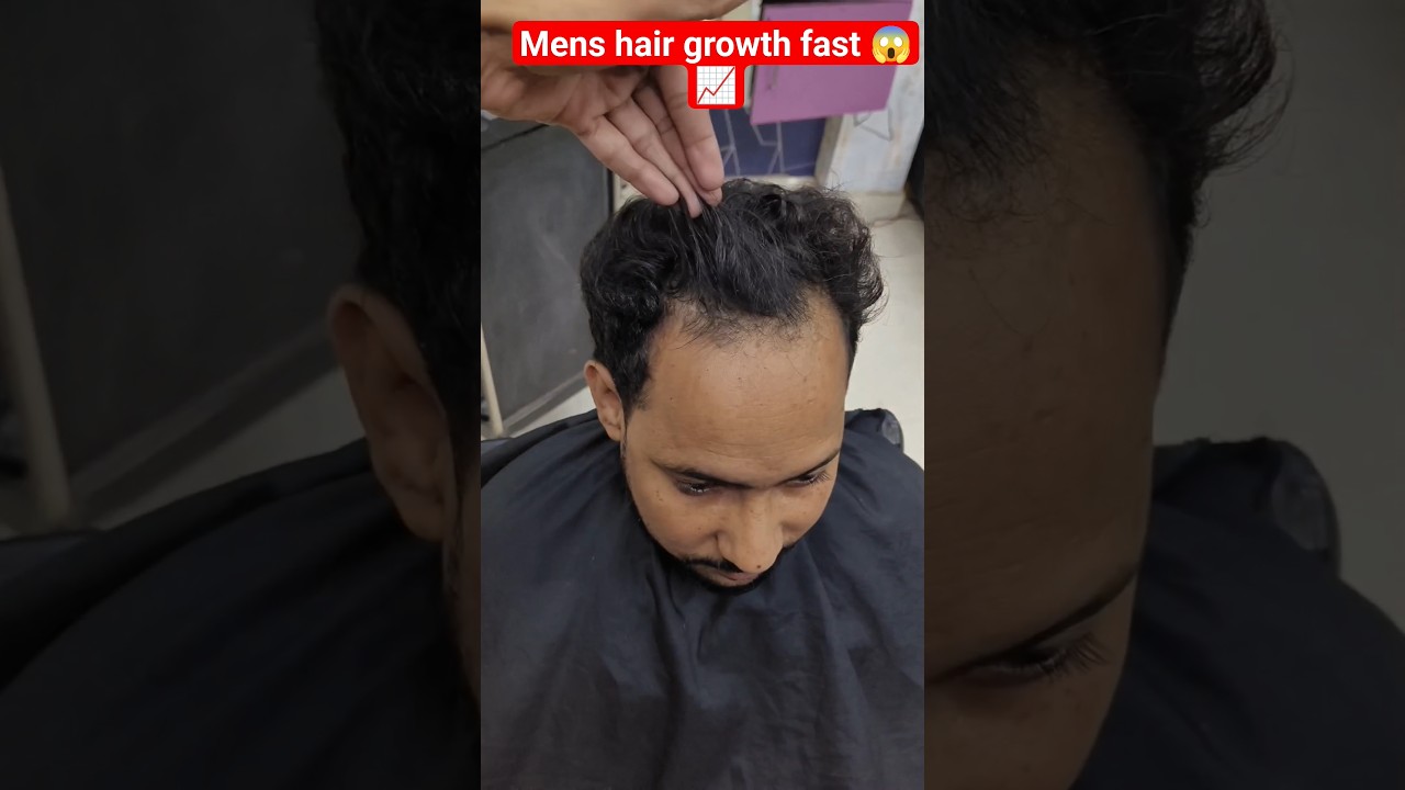 "Gents Hair Growth Result! Jadon se baal lamba 🔥 Final Look 