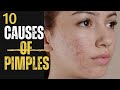 Does Eating Oily Foods Causes Acnes ?