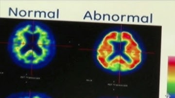Cutting edge research into memory disorders