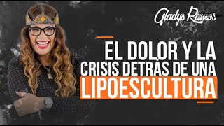 EL DOLOR Y LA CRISIS DETRAS DE UNA LIPOESCULTURA