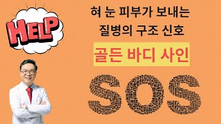 골든바디사인. 혀 눈 피부가 알려주는 치명적 질병의 골든타임. Golden body sign