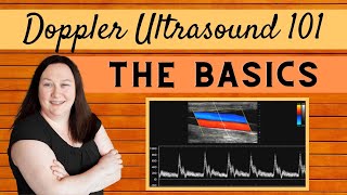 Doppler Ultrasound 101 | The Basics