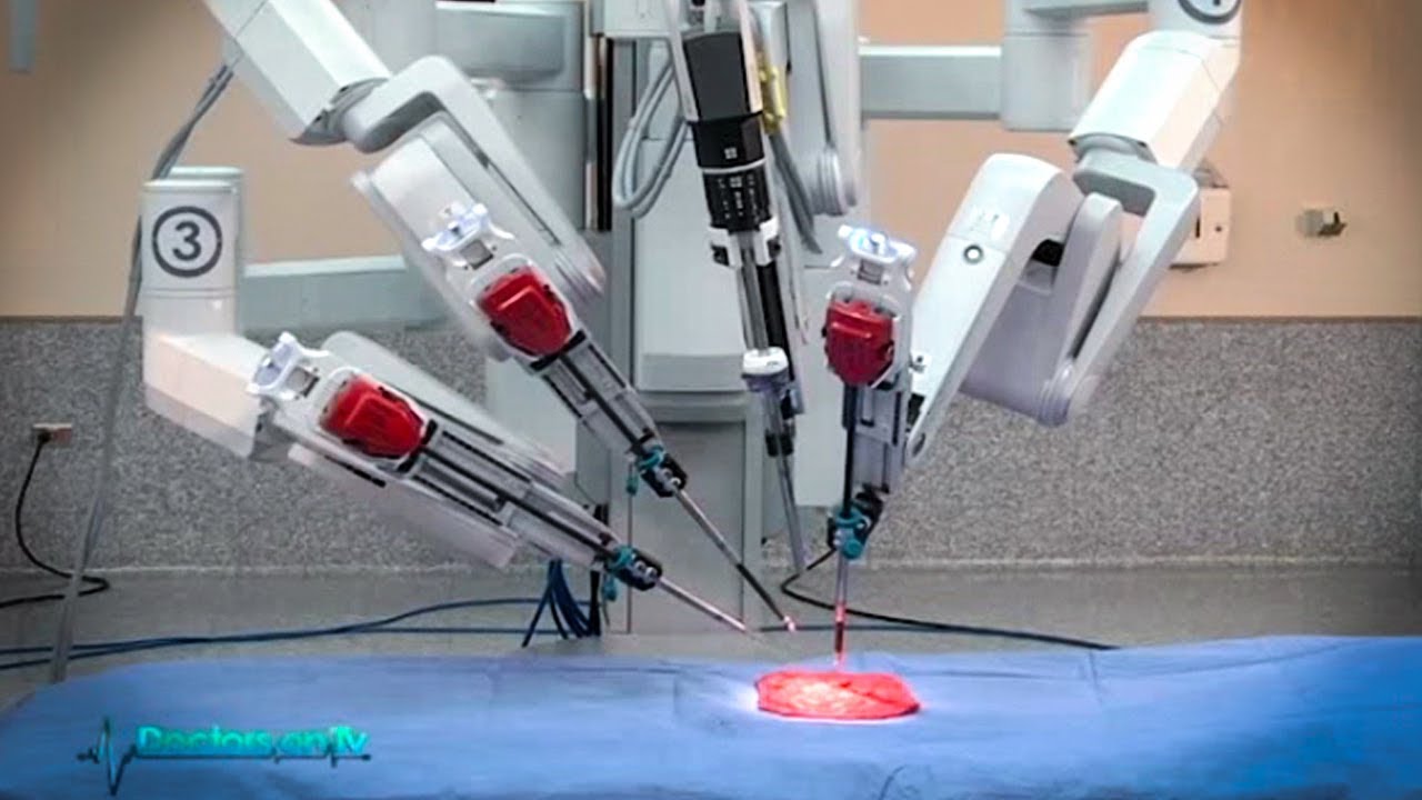 vælge effektiv Invitere Actual demo of robotic surgery for prostate cancer - YouTube