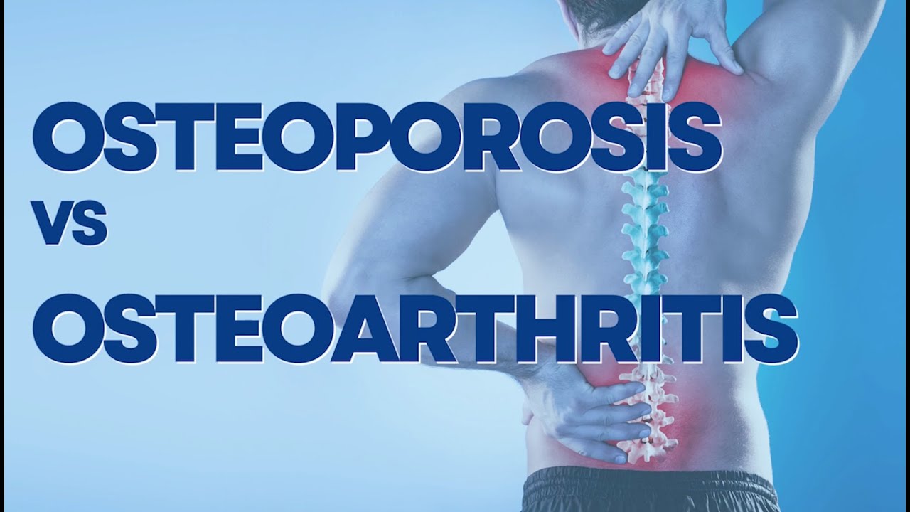 Osteoporosis at Osteoarthritis: Ano ang pagkakaiba?