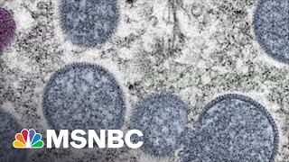 Monkeypox Cases Go Global | The Mehdi Hasan Show