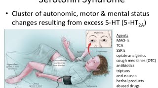 Serotonin Syndrome