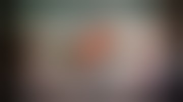 CataractCoach™ 1925: pupil stretching is safe, easy, and effective