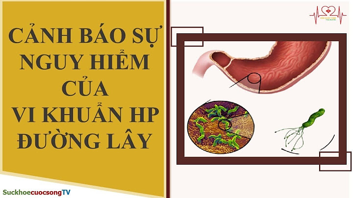 Helicobacter pylori igg là gì