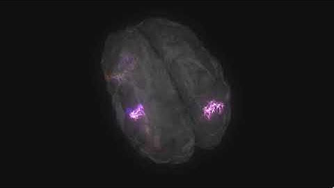 Anohni. The effect of her music on the brain