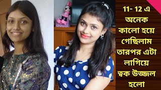 11- 12 এ অনেক কালো হয়ে গেছিলাম | How To Make Skin Glow | Skin Fairness Face Pack screenshot 5