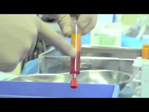 Video: Tekenen Van Een Slechte Plastisch Chirurg