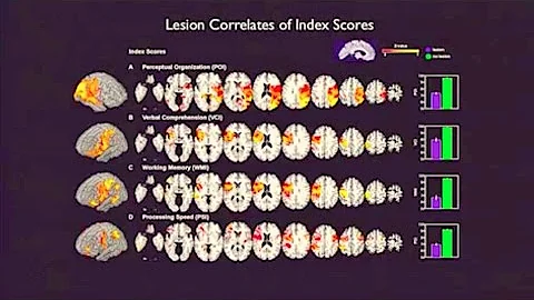 Ralph Adolphs: 2012 Seattle Brain Salon
