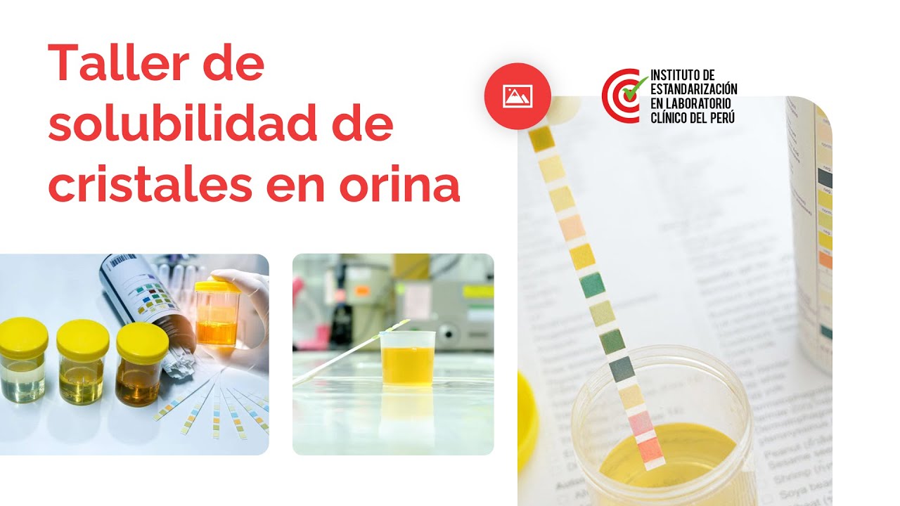 Taller de solubilidad de cristales en orina