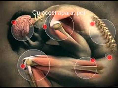 Unguent natural pentru osteocondroza cervicala